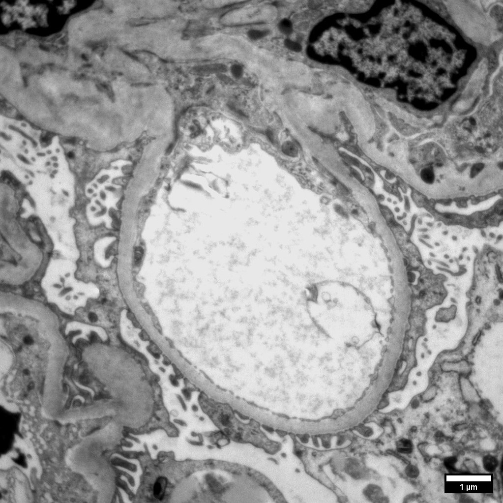 Fig F. Whole glomerulus in view, Mid magnification. Image